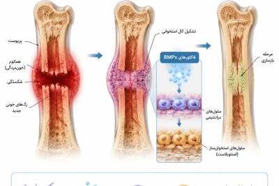 نقش فاکتورهای رشد (BMPs) در ترمیم استخوان | بررسی روند بازسازی و جوش‌خوردگی استخوان