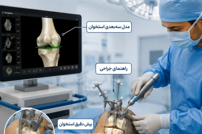 طراحی برش استخوان با سیستم‌های هدایت‌شونده | دقت نوین در جراحی ارتوپدی