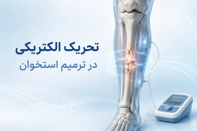 کاربرد تحریک الکتریکی در ترمیم استخوان | روشی نوین برای تسریع جوش خوردن شکستگی‌ها