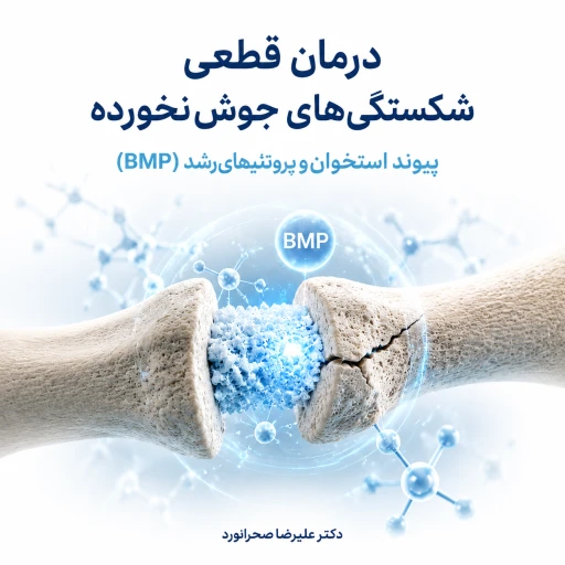 درمان شکستگی‌های جوش‌نخورده با پیوند استخوان و BMP | راهکارهای نوین ترمیم استخوان