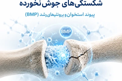 درمان شکستگی‌های جوش‌نخورده با پیوند استخوان و BMP | راهکارهای نوین ترمیم استخوان