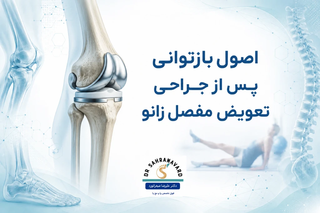 اصول بازتوانی پس از جراحی تعویض مفصل زانو | راهنمای جامع توانبخشی و بهبود عملکرد