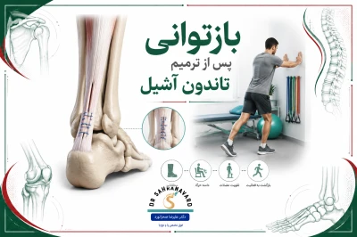 بازتوانی پس از ترمیم تاندون آشیل | مراحل و زمان‌بندی استاندارد درمان