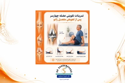 تمرینات تقویتی عضله چهارسر پس از آرتروپلاستی زانو | راهنمای جامع بازتوانی و بهبود عملکرد مفصل