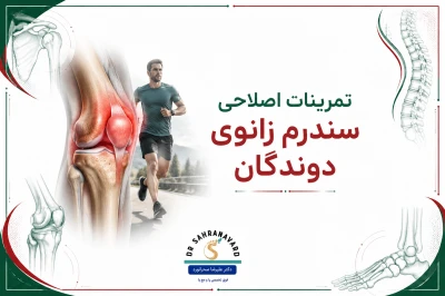تمرینات اصلاحی برای سندرم زانوی دوندگان | راهنمای علمی کاهش درد و تقویت مفصل زانو