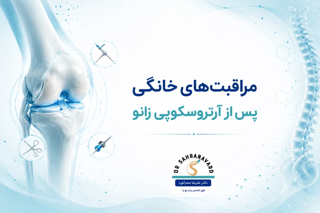 مراقبت‌های خانگی پس از جراحی آرتروسکوپی زانو
