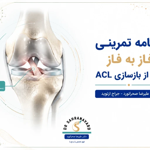 برنامه تمرینی فاز به فاز بعد از بازسازی ACL | راهنمای جامع توانبخشی رباط صلیبی قدامی