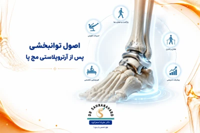 اصول توانبخشی پس از آرتروپلاستی مچ پا | راهنمای کامل بازگشت عملکرد مفصل