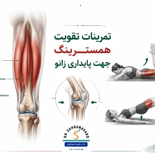 تمرینات تقویت همسترینگ برای بهبود پایداری زانو