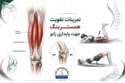 تمرینات تقویت همسترینگ برای بهبود پایداری زانو