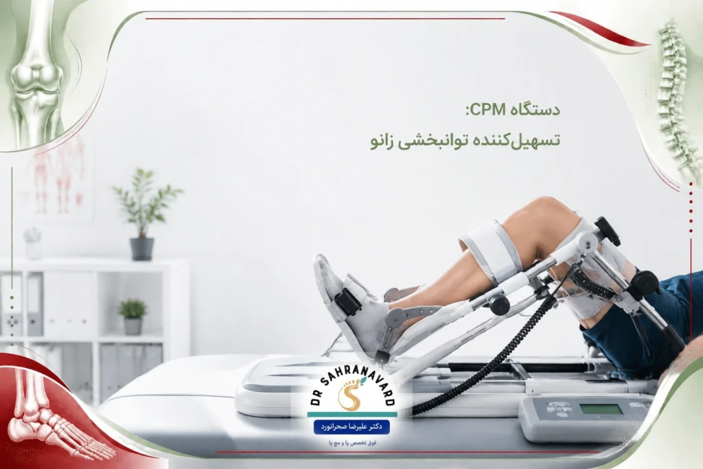 کاربرد دستگاه CPM در افزایش دامنه حرکتی مفصل| راهکارهای بازتوانی سریع زانو