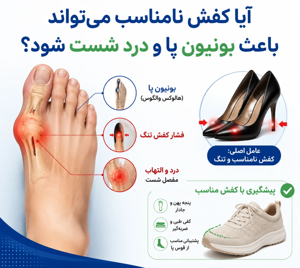 آیا کفش نامناسب می‌تواند باعث بونیون پا و درد شست شود؟ | بررسی نقش کفش در هالوکس والگوس