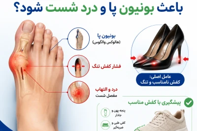 آیا کفش نامناسب می‌تواند باعث بونیون پا و درد شست شود؟ | بررسی نقش کفش در هالوکس والگوس