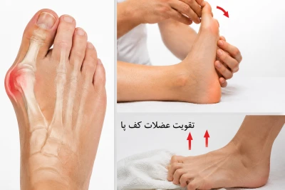 تمرینات اصلاحی مؤثر برای انحراف شست پا | تقویت عضلات کف پا و کاهش درد