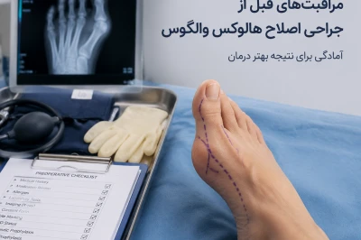مراقبت‌های قبل از جراحی اصلاح هالوکس والگوس | راهنمای آماده‌سازی برای نتیجه بهتر درمان