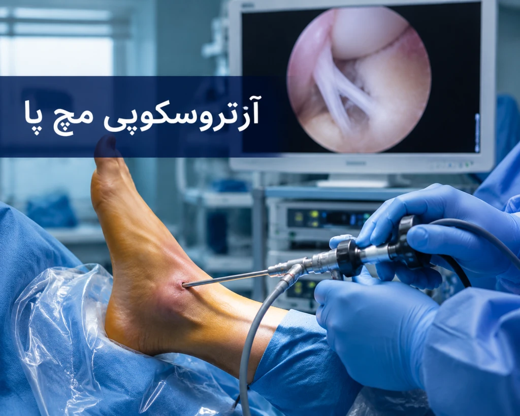 نقش آرتروسکوپی در درمان آسیب رباطی و درد مزمن مچ پا | بررسی روش‌های نوین درمانی