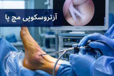 نقش آرتروسکوپی در درمان آسیب رباطی و درد مزمن مچ پا | بررسی روش‌های نوین درمانی