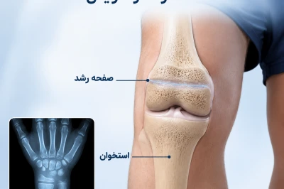 نقش صفحات رشد در افزایش قد و زمان بسته شدن آن‌ها | راهنمای جامع رشد استخوان