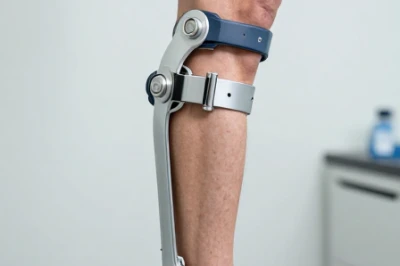 بلند کردن استخوان پا با روش Limb Lengthening  | مراحل افزایش قد و مراقبت‌ها