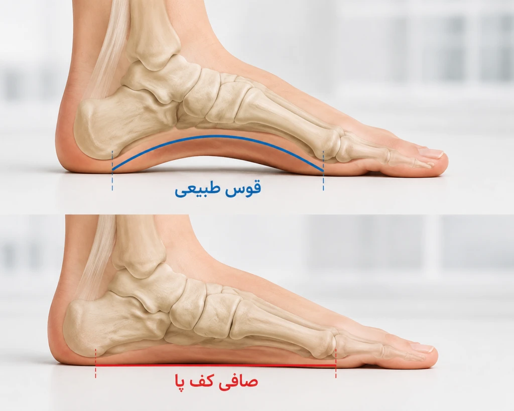 علت صافی کف پا در بزرگسالان | بررسی عوامل موثر و درمان درد پا