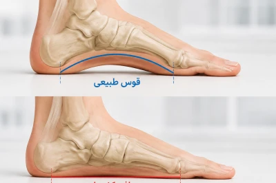 علت صافی کف پا در بزرگسالان | بررسی عوامل موثر و درمان درد پا
