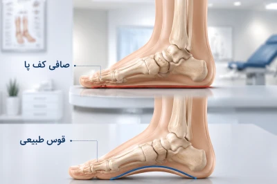 آیا صافی کف پا ارثی است؟ | بررسی نقش ژنتیک در قوس کف پا