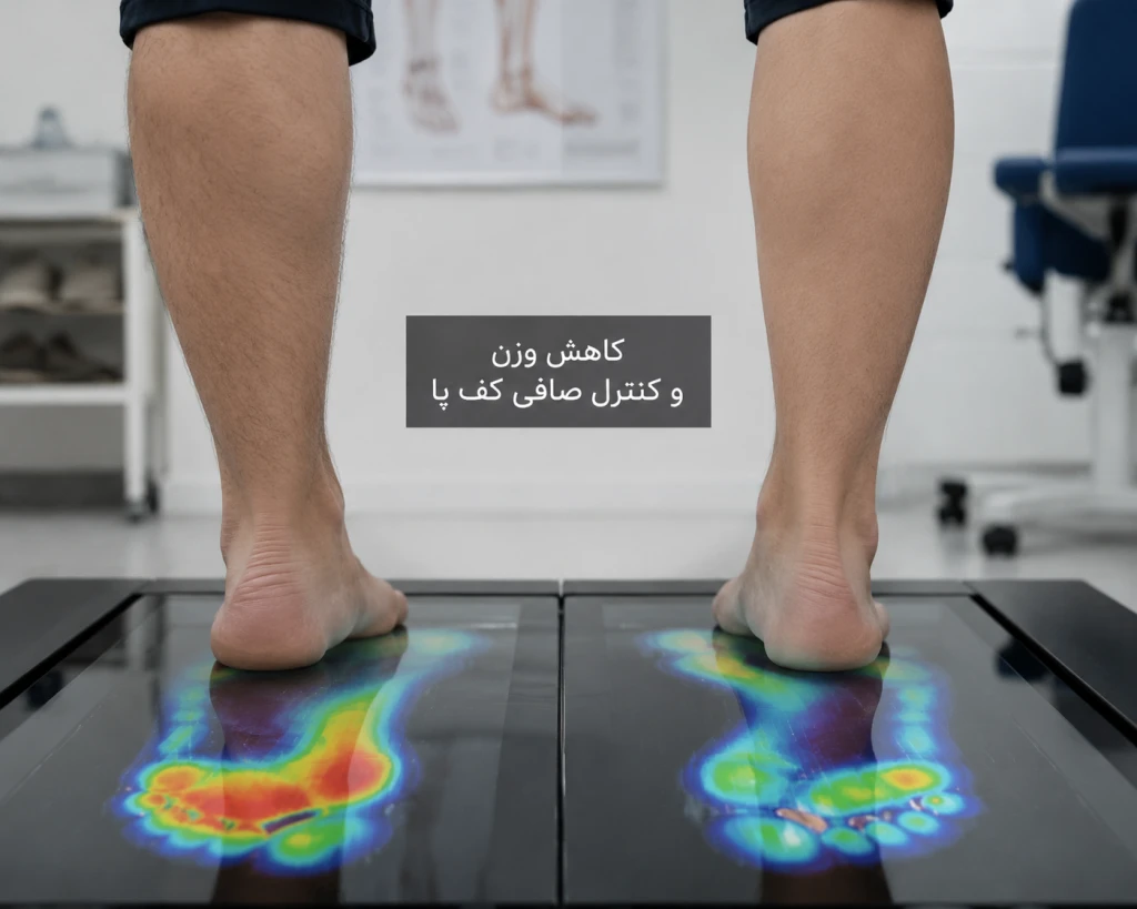 نقش کاهش وزن در درمان و کنترل صافی کف پا | بررسی تأثیر وزن در کاهش درد پا و بهبود عملکرد قوس کف پا