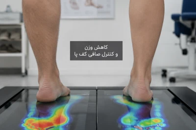 نقش کاهش وزن در درمان و کنترل صافی کف پا | بررسی تأثیر وزن در کاهش درد پا و بهبود عملکرد قوس کف پا