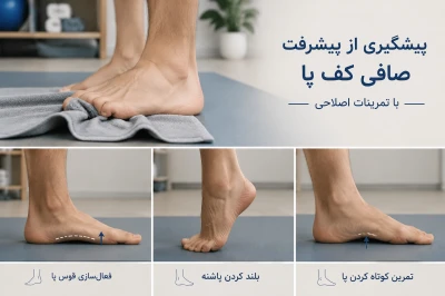 چگونه با تمرینات اصلاحی از پیشرفت صافی کف پا جلوگیری کنیم | راهکارهای پیشگیری و کنترل افتادگی قوس پا