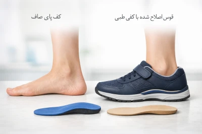 آیا کفی طبی می‌تواند صافی کف پا را اصلاح کند | بررسی نقش کفی طبی در درمان صافی کف پا