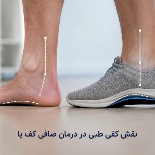 نقش کفش مناسب در اصلاح بیومکانیک پا | راهنمای علمی برای کاهش درد و بهبود صافی کف پا