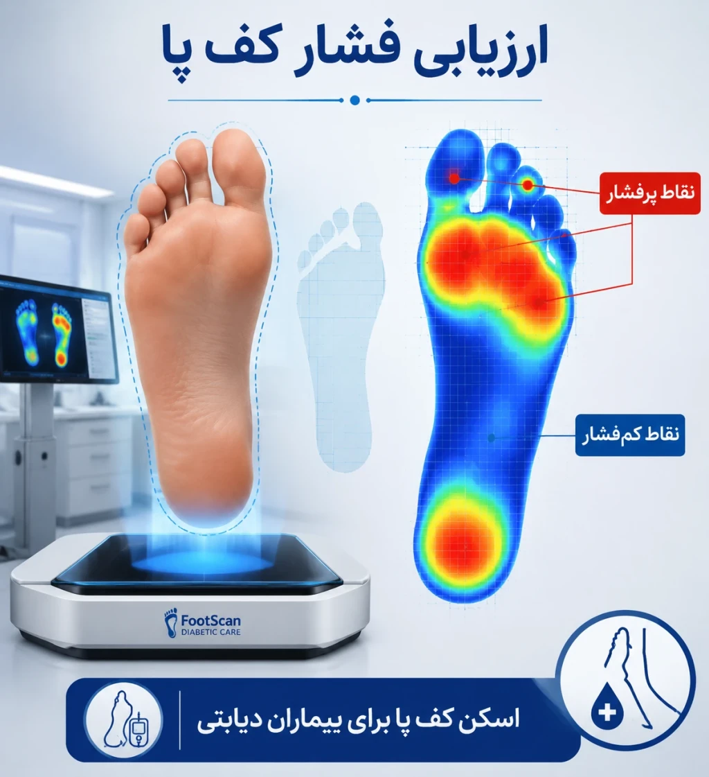 ارزیابی فشار کف پا در بیماران دیابتی