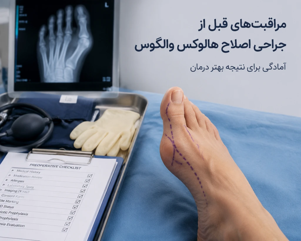 مراقبتهای قبل از جراحی اصلاح هالوکس والگوس | راهنمای آمادهسازی برای نتیجه بهتر درمان