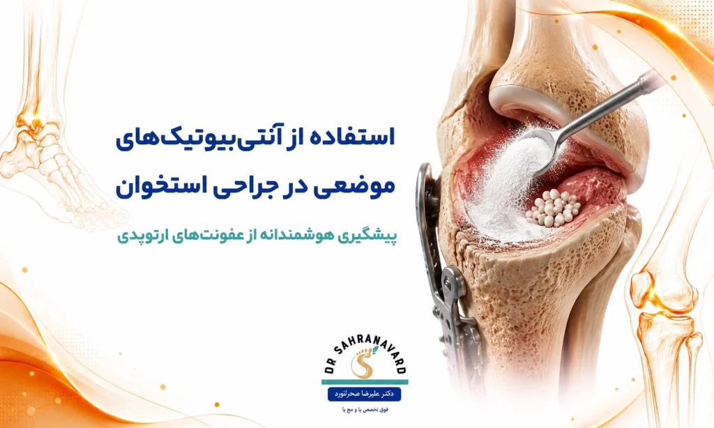 استفاده از آنتی‌بیوتیک‌های موضعی در جراحی استخوان | نقش آن در پیشگیری از عفونت‌های ارتوپدی