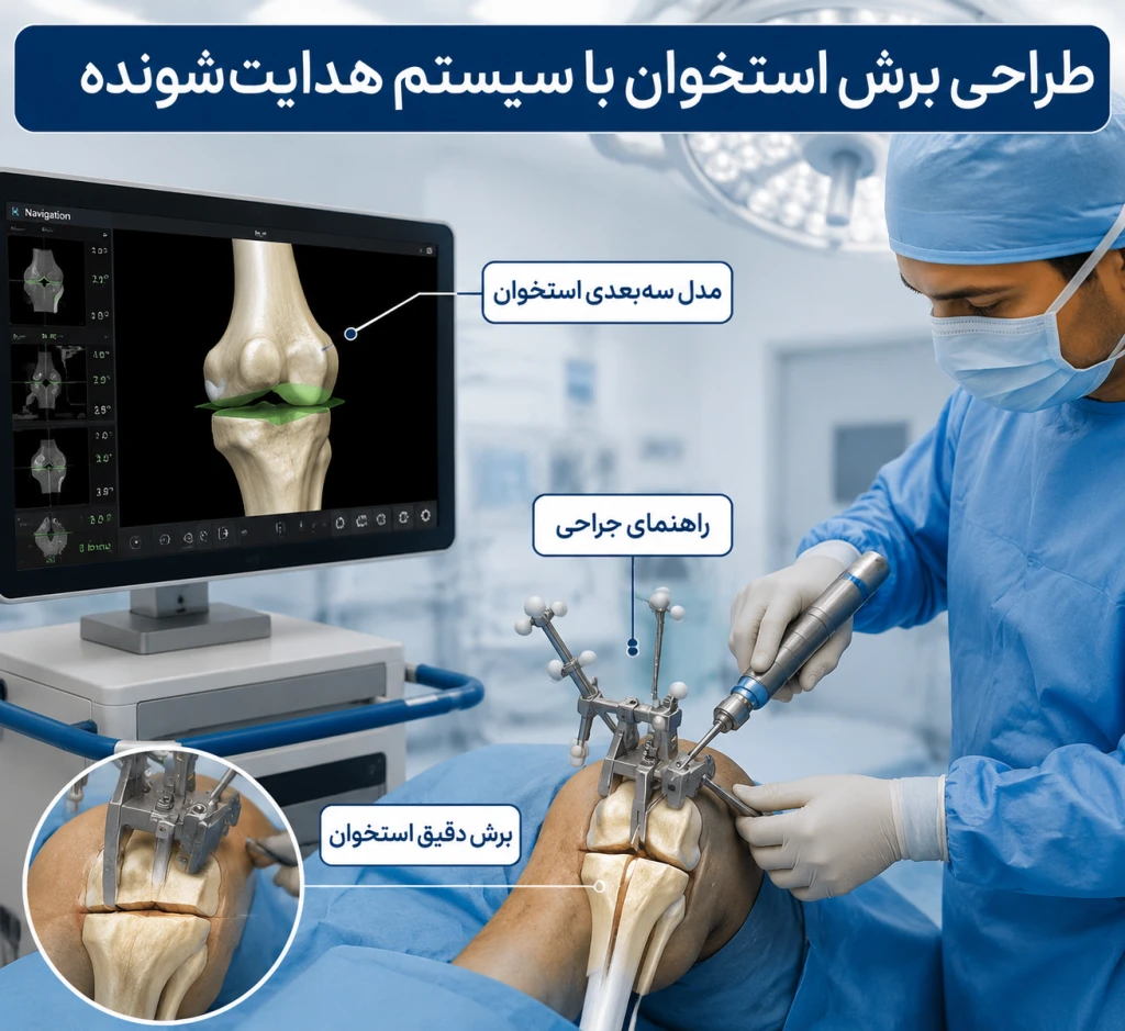 طراحی برش استخوان با سیستم‌های هدایت‌شونده | دقت نوین در جراحی ارتوپدی