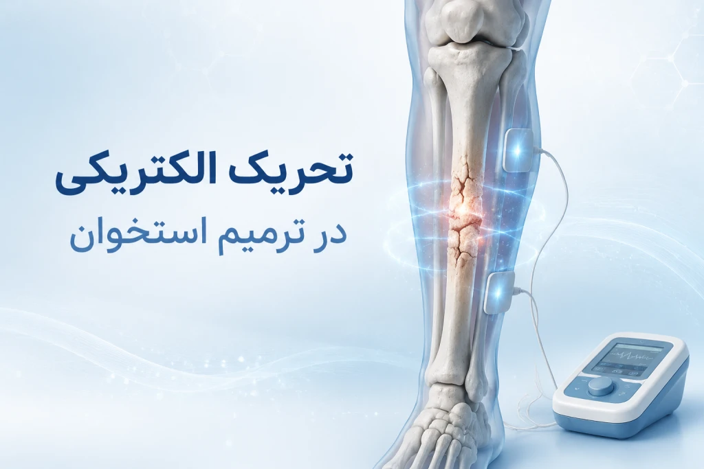 کاربرد تحریک الکتریکی در ترمیم استخوان | روشی نوین برای تسریع جوش خوردن شکستگیها