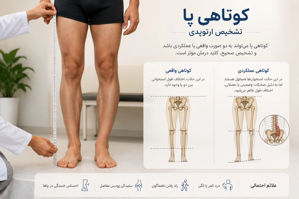 تفاوت کوتاهی واقعی پا با کوتاهی عملکردی چیست و چگونه تشخیص داده می‌شود؟