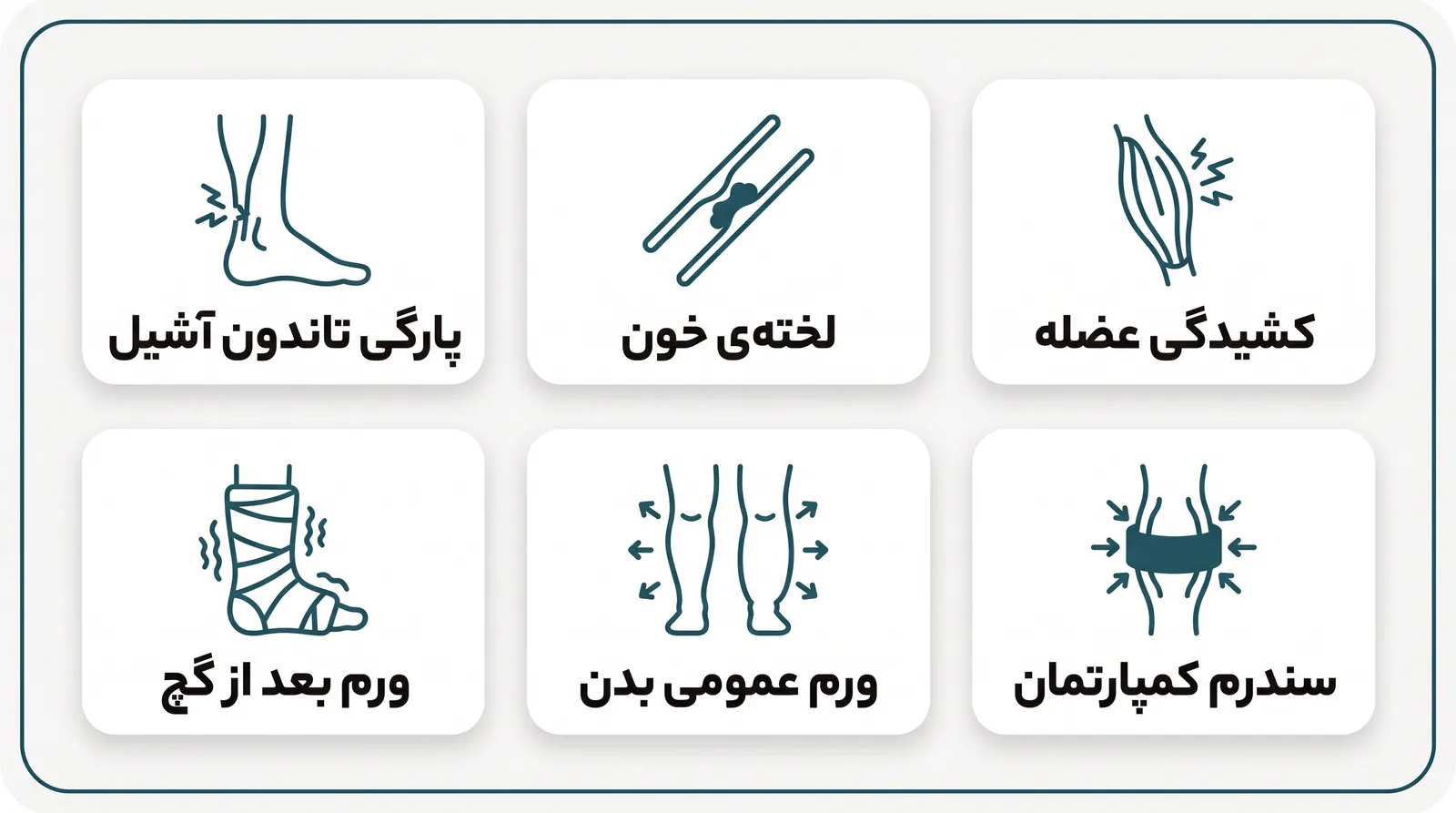اینفوگرافیک شش علت ورم ماهیچه پا: کشیدگی عضله، لخته، پارگی آشیل، کمپارتمان، ورم عمومی و ورم بعد از شکستگی