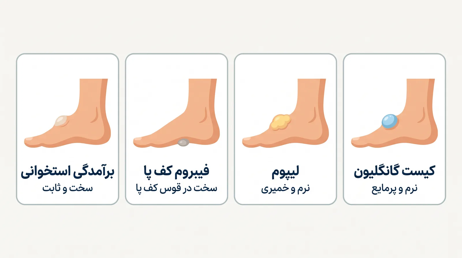 مقایسه‌ی کیست گانگلیون با لیپوم، فیبروم کف پا و برآمدگی استخوانی روی پا